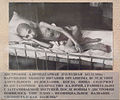 A Soviet civilian starving to death because of the Nazis' siege of Leningrad