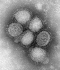 Immagine al microscopio elettronico del virus N1H1. I virus hanno un diametro di 80-120 nanometri.