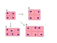Normal hücreler (A), Hipertrofi (B), Hiperplazi (C) ve kombinasyon (D).