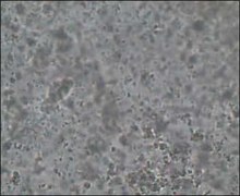 Play media file Sperm under the light microscope