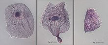 Apoptosis