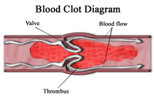 Schematic representation