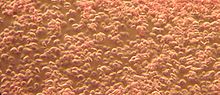 Dark field image of human blood, 1000x magnification
