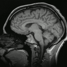 Egy emberi koponya MRI segítségével készített képe