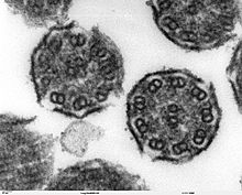 Secondary cilia under the electron microscope: in cross-section the structure 9 × 2 + 2 becomes visible.