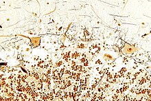 Tissue section from the cerebellum (Bielschowsky stain): In the image above, surrounded by glia stained light brown, the processes and large cell bodies of a few Purkinje cells are in close contact with some black-stained processes of basket cells. Below the position of the cerebellar granule cells; in mammals they represent more than 50 % of all neurons.