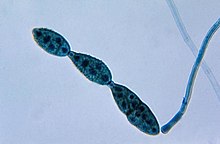La reproduction asexuée chez l'Ascomycota se fait par la formation de conidies, un type de spore. Voici une chaîne de quatre conidies d'Alternaria