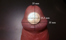 Slappe penis eikel  