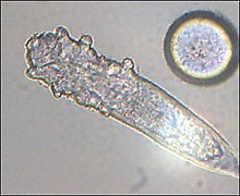 Fotografie la microscop a unui acarian Demodex care se hrănește cu sebum.