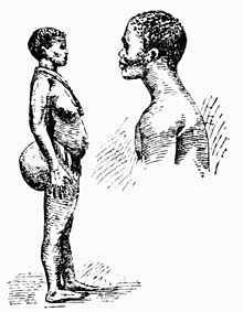 Khoikhoi žena a muž (kresba z roku 1900). U ženy se projevuje steatopygie.
