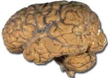 Prepared human brain