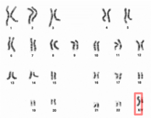 karyogram of a male
