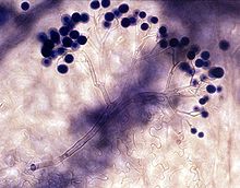 Konidiophore af Hyaloperonospora parasitica med flere konidier