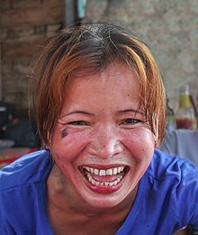 Laughter