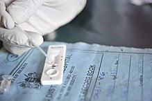 Test za hitro diagnostiko malarije (RDT), ki se uporablja v Keniji. RDT za postavitev diagnoze malarije potrebuje približno 20 minut. Uporaben je na območjih, kjer laboratorijsko testiranje ni na voljo, vendar ni zanesljiv.