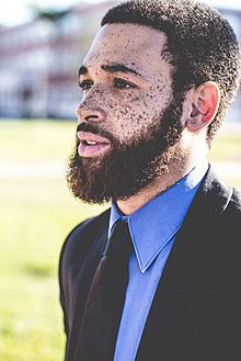 Man with freckles