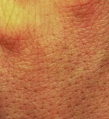 Close-up of human skin (here field skin) . 