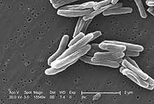 Electron micrograph of the tubercle bacilli