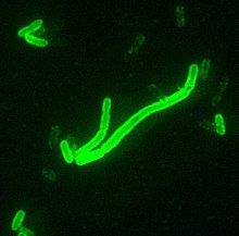 Septicemic plague