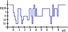 The normal sleep stages of a night. It can be clearly seen that during a normal course of events, both the deepest sleep phase (IV) and the waking state (-) are reached several times.