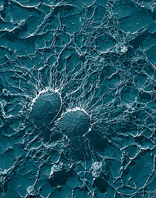 Staphylococcus aureus , ampliado x50.000, imagem por microscópio eletrônico de transmissão