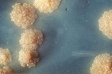 Un primer plano de un cultivo de M. tuberculosis. Las manchas que parecen espuma son el patrón de crecimiento típico de estas bacterias  