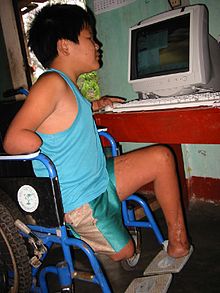 Landmine victims in Vietnam