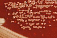 Yersinia enterocolitica colônias crescendo em placas de ágar XLD