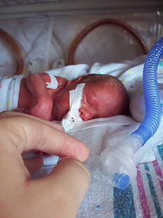 Bebé prematuro en una incubadora