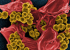 Meticilīnam rezistenta Staphylococcus aureus un miruša cilvēka neitrofila skenēšanas elektronu mikrofotogrāfija