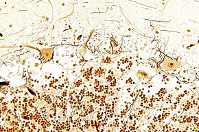 Tissue section from the cerebellar cortex (Bielschowsky stain): Surrounded by glia, the top image shows the light brown stained processes and large cell bodies of a few Purkinje cells in close contact with some black stained processes of basket cells; below, the location of cerebellar granule cells, which account for more than half of all neurons in mammals.