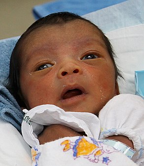 Infant, 10 days old