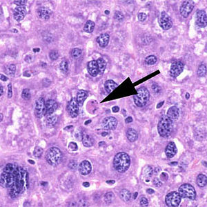 Apoptotic cell of a mouse liver