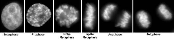 In addition to a nucleus in interphase shown for comparison, the different stages of mitosis are shown.
