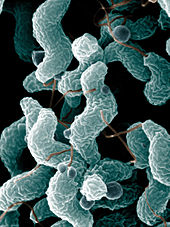 Campylobacter, bakterija, ki je glavni povzročitelj zastrupitev s hrano.