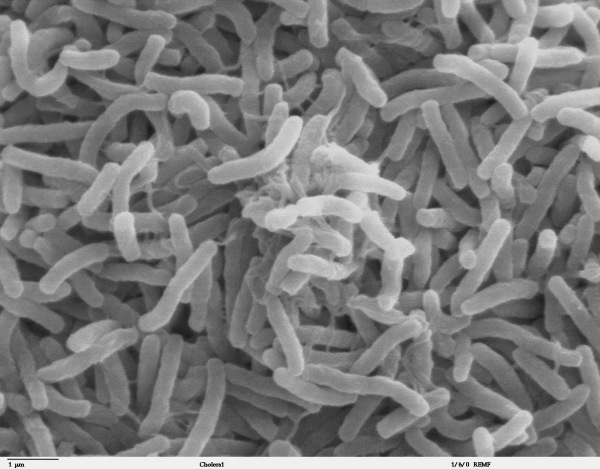 Immagine al microscopio elettronico a scansione dei batteri che causano il colera.