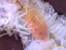 Tracheální systém se větví na postupně se zmenšující trubice, které zásobují plodnice švába. Měřítko 2 mm  