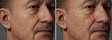 AI generated freckles on a 3D head