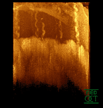 Optical coherence tomography of the fingertip (groin skin) in vivo with sweat gland excretory ducts