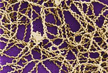 Leptospira-Spirochaeten unter dem Rasterelektronenmikroskop
