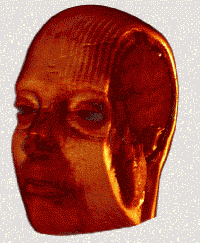 Volume rendering of a head MRI