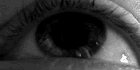 Nistagmus optocinetic orizontal (de la o parte la alta). De asemenea, ochii se pot mișca în sus și în jos (nistagmus optokinetic vertical).