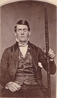 Phineas Gage s tyčí, která mu způsobila TBI  