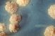 Un primer plano de un cultivo de Mycobacterium tuberculosis. Las manchas que parecen espuma son el patrón de crecimiento típico de estas bacterias  