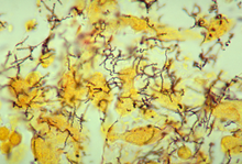 Treponema pallidum bacteria